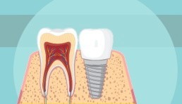 Aktualności Medicus